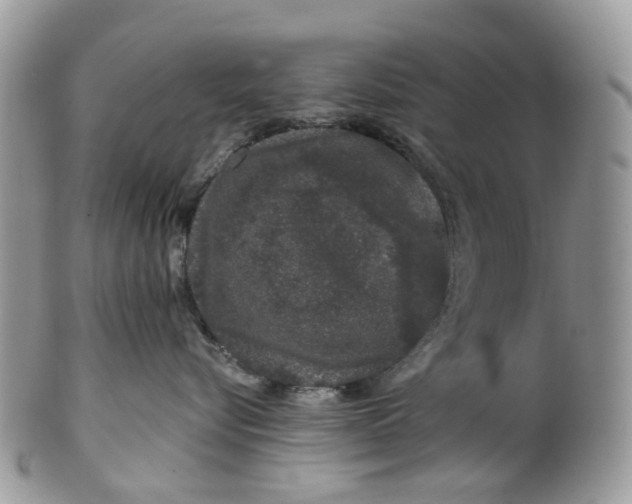 X0000099500576200806051126