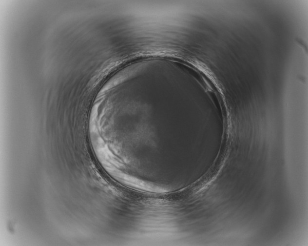 X0000099500577200806051125