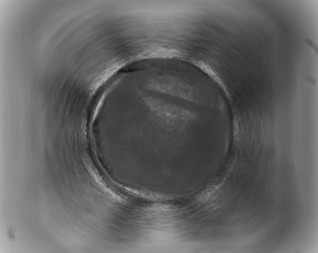 X0000099500581200806051125