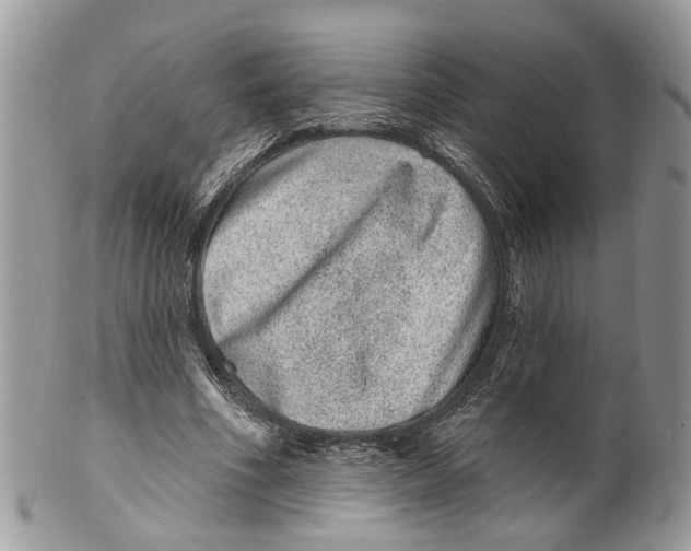 X0000099500586200806051125