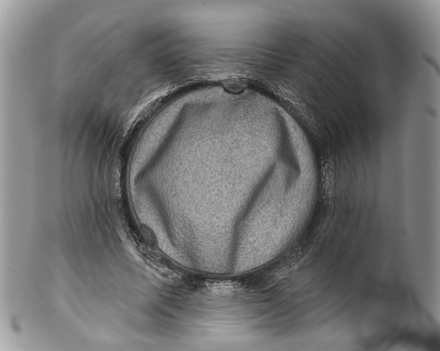 X0000099500587200806051125