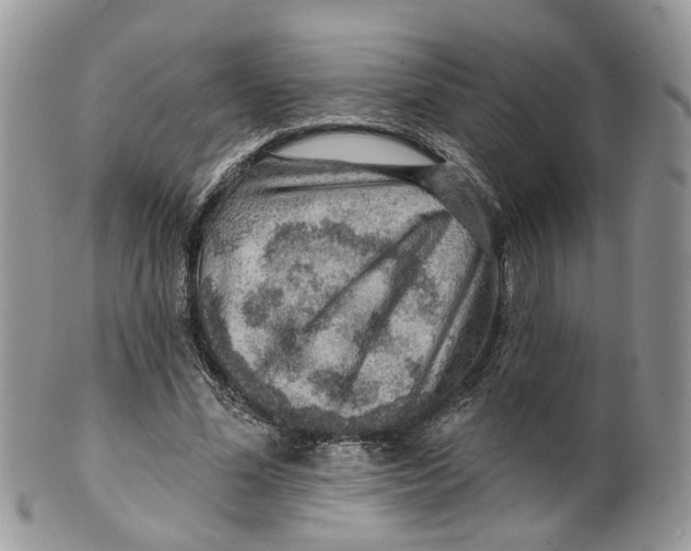 X0000099500588200806051125