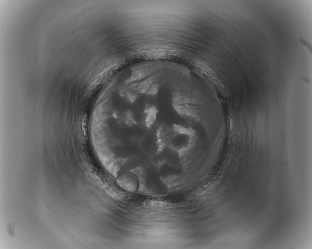 X0000099500590200806051125