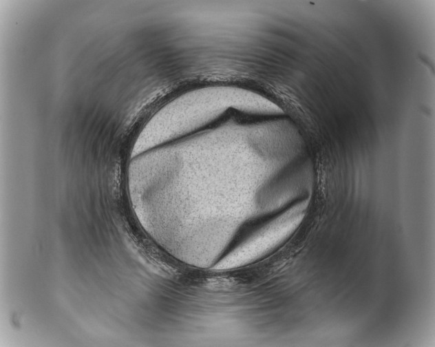 X0000099500591200806051125