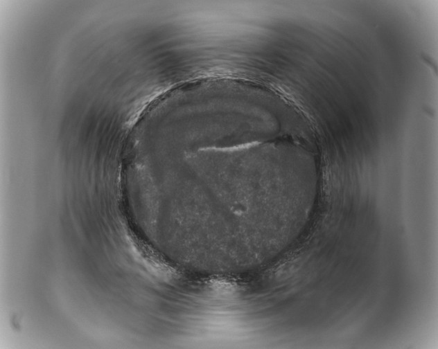 X0000099500592200806051125