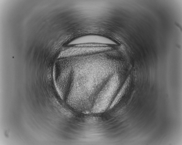 X0000099500593200806051125