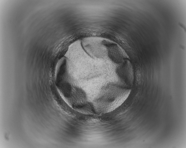 X0000099500594200806051125