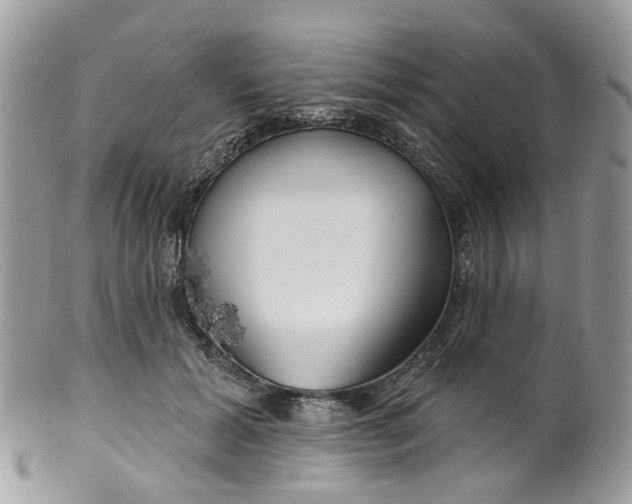 X0000099500605200806051125