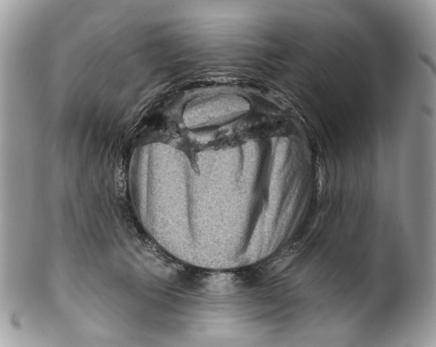 X0000099500609200806051125