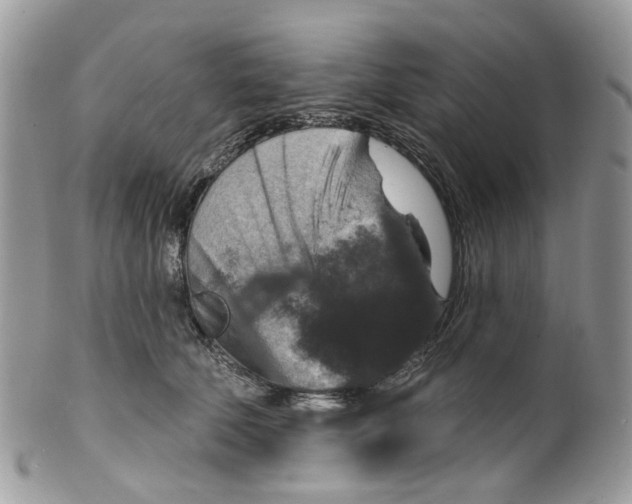 X0000099500610200806051125