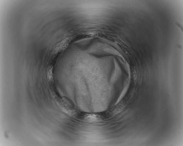 X0000099500611200806051125