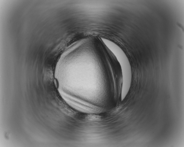 X0000099500617200806051125