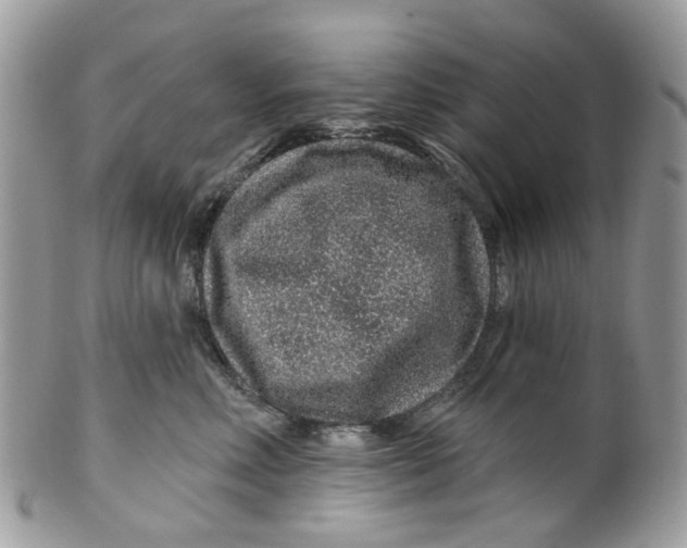 X0000099500618200806051125