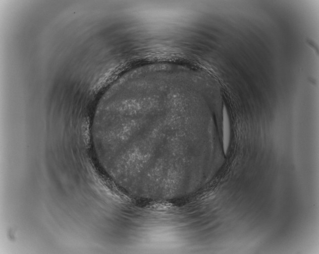 X0000099500642200806051124