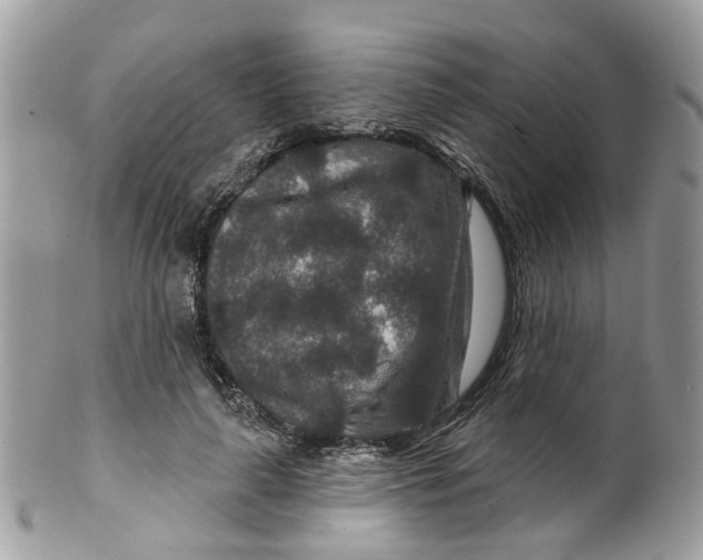 X0000099500643200806051124