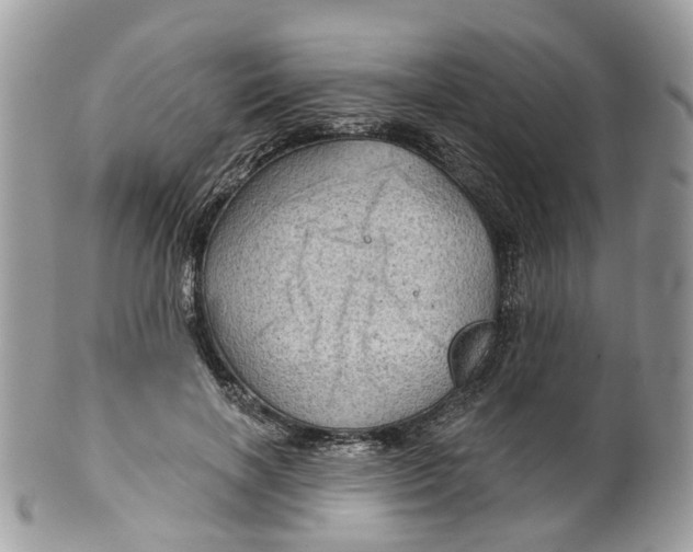 X0000099500646200806051124