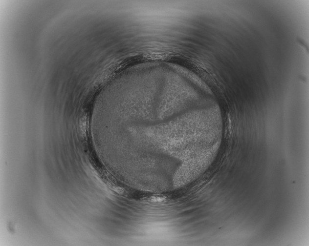 X0000099500647200806051124