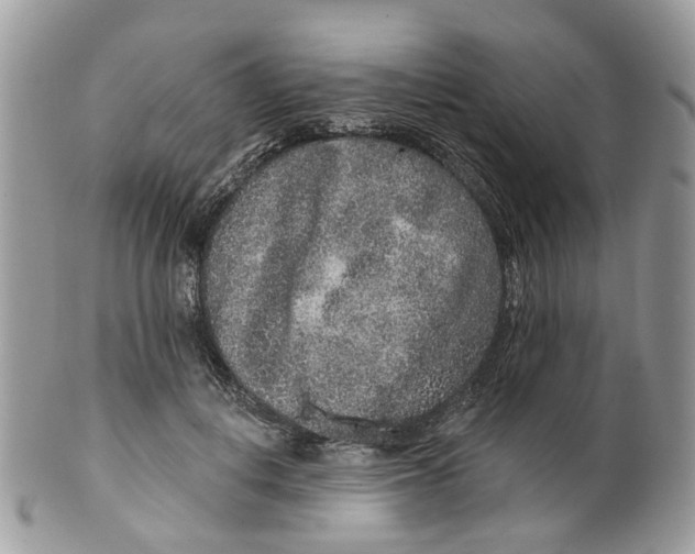 X0000099500648200806051124