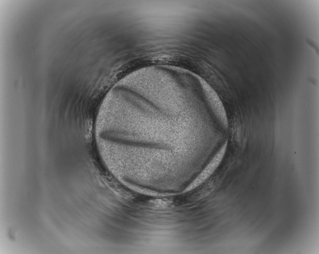 X0000099500660200806051124