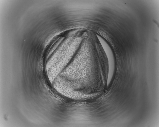 X0000099500676200806051123