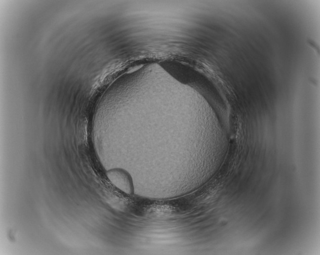 X0000099500685200806051123