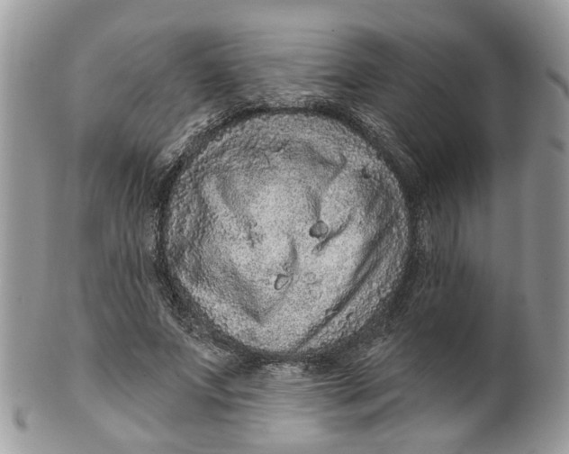 X0000099500687200806051123