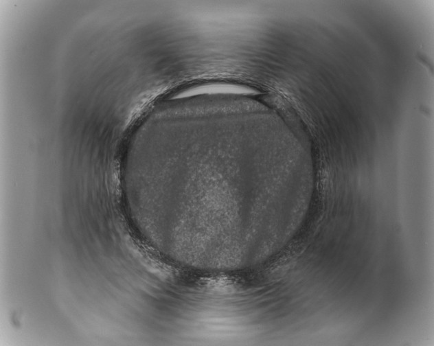 X0000099500688200806051123