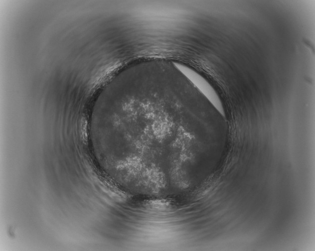 X0000099500692200806051123