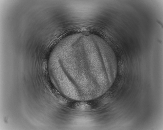 X0000099500747200806051122