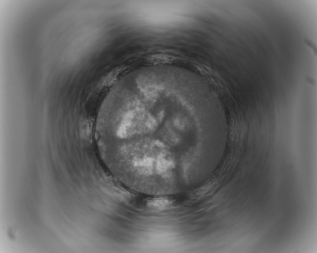 X0000099500759200806051123