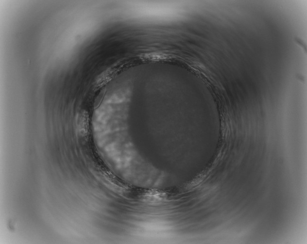 X0000099500760200806051123