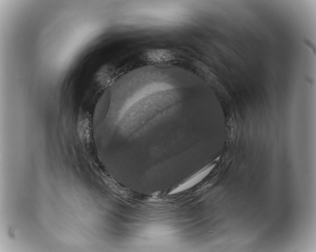 X0000099500762200806051123