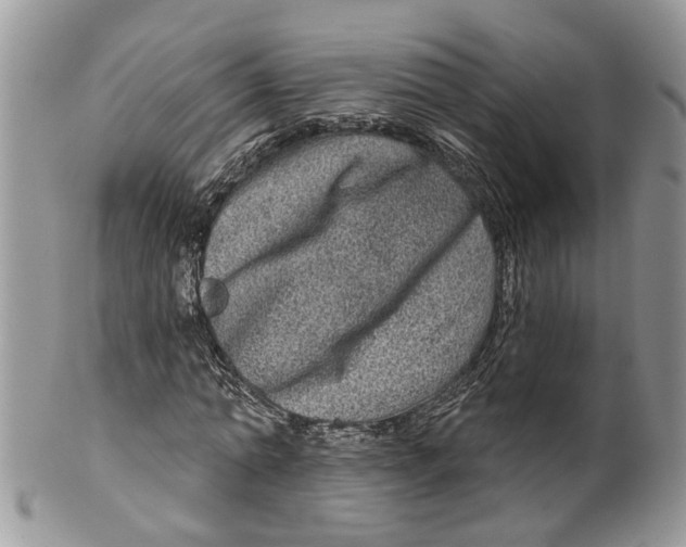 X0000099500774200806051122