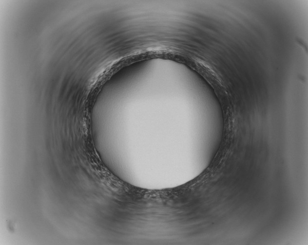 X0000099500776200806051122