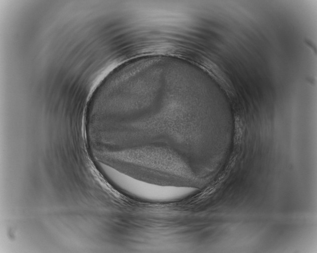 X0000099500788200806051122