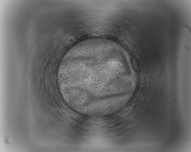 X0000099500817200806051120