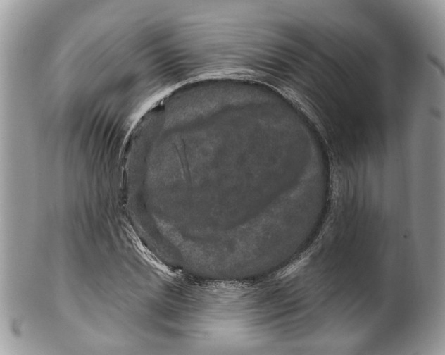 X0000099500830200806051121