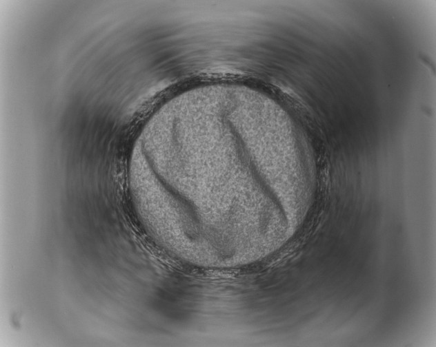 X0000099500870200806051120