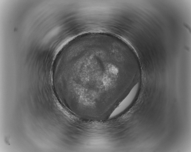 X0000099500935200806051119