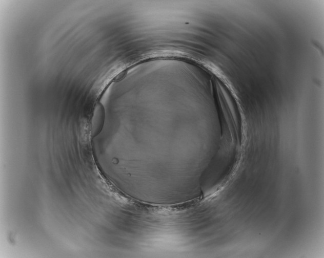 X0000099500945200806051119