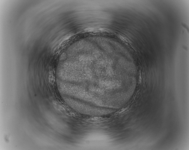 X0000099500966200806051119