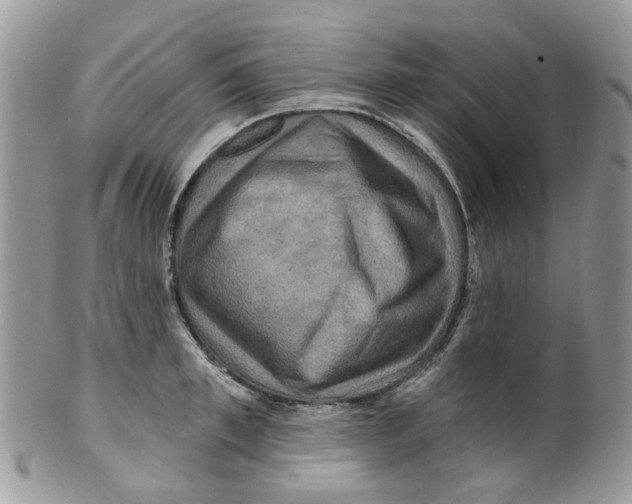 X0000099500997200806051118