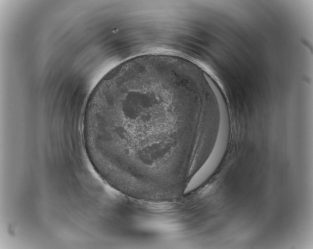 X0000099501007200806051118