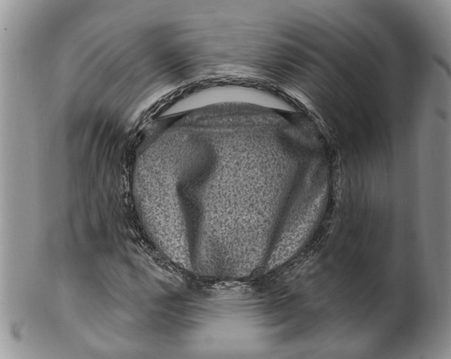 X0000099501112200806051116