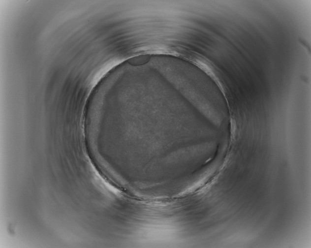 X0000099501141200806051116