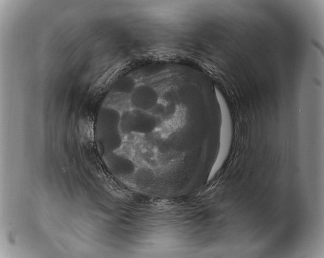 X0000099501155200806051116