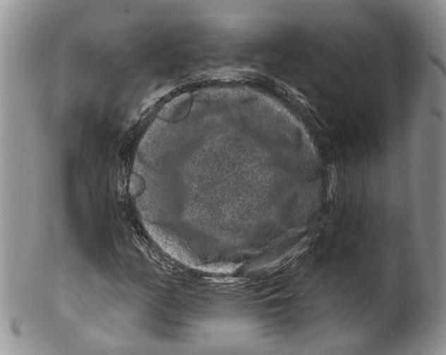 X0000099501158200806051116