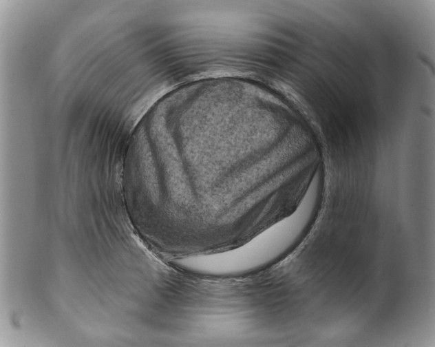 X0000099501185200806051115