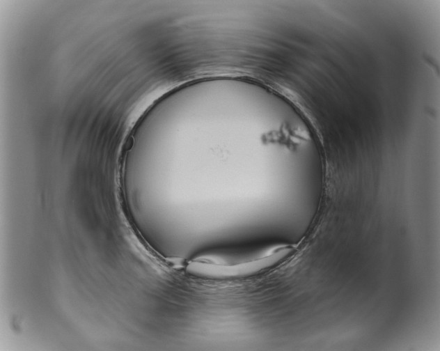 X0000099501187200806051115