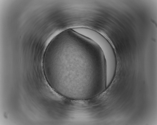 X0000099501197200806051115